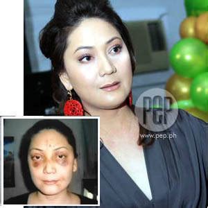 rachel tiongson cogie domingo|Che Tiongson recounts Chavit torture and trauma, recalls 17.
